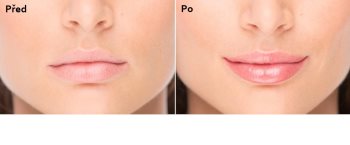 FacEvolution LipPlus догляд для збільшення об'єму губ
