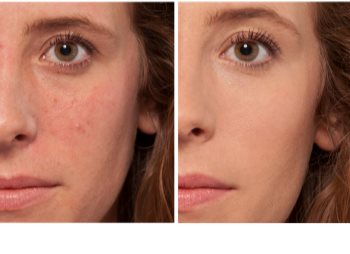 L’Oréal Paris True Match Magique Touch corector iluminator