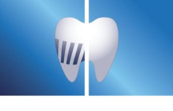 Philips Sonicare AirFloss Ultra HX8032/07 Interdental-Düsen