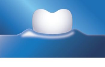 Philips Sonicare AirFloss Ultra HX8032/07 Interdental-Düsen