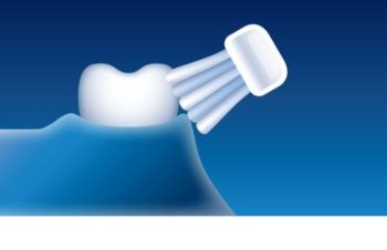 Philips Sonicare DiamondClean HX9372/04 sonická elektrická zubná kefka s nabíjacím pohárom