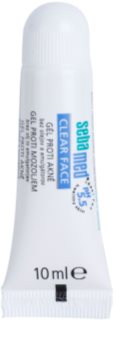 Sebamed Clear Face gel protiv akni