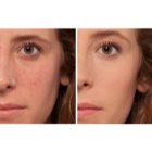 L’Oréal Paris True Match Magique Touch corector iluminator